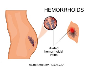 ilustración vectorial de publicaciones médicas sobre el tema de la cirugía
