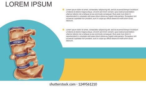 Vector Illustration Of A  Medical Slipped Disc