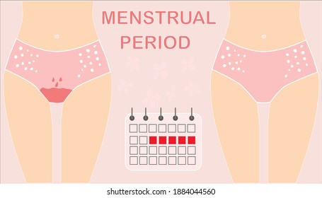 Vector Illustration Of Menstrual Calendar. Before And After Menstruation. The Period Is Not A Taboo.