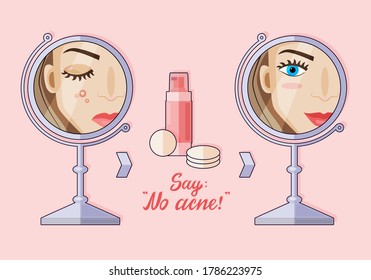 Vector illustration of a modern flat cartoon character. A girl who doesn't have skin problems. Before and after. Acne lotion. No acne.