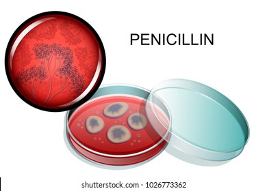 Vector Illustration Of A Mold Of Penicillin, In A Petri Dish And Under A Microscope
