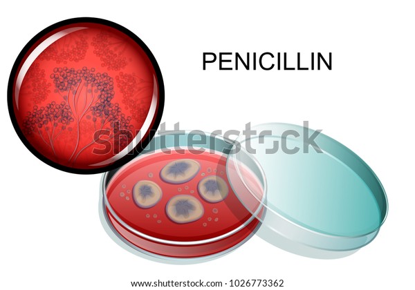 ペトリ皿と顕微鏡の下のペニシリンの鋳型のベクターイラスト のベクター画像素材 ロイヤリティフリー