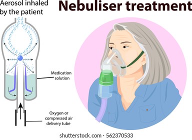 Vector Illustration Of Nebulizer Treatment Anatomy