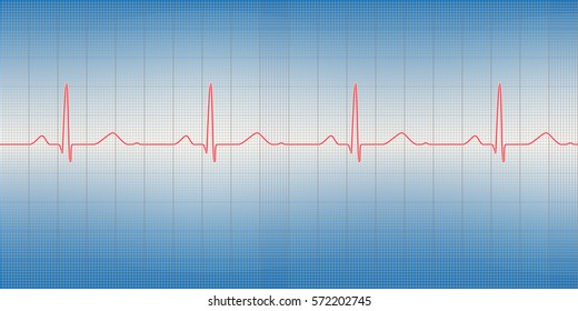 Vector illustration of normal cardiogram