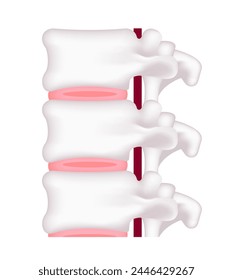 Vector illustration of normal disc