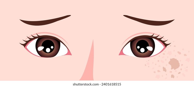 Ilustración vectorial de la piel facial normal y de la piel facial con manchas.