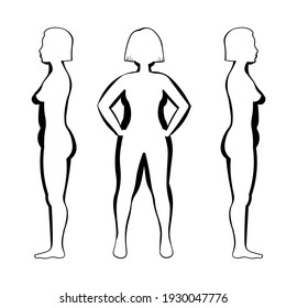 Vector illustration of obesity woman body. Vector figure overweight silhouette. Front and side view.