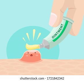 Vector illustration of an ointment being put on a pimple