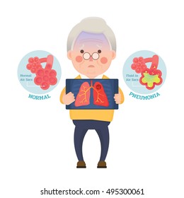 Vector Illustration of Old Man Holding X-ray Image Showing Lung Pneumonia Problem, Cartoon Character
