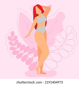 Vector illustration on the theme of body positivity. A girl with stretch marks on her thighs with long red hair on a background of beautiful leaves. Flat style