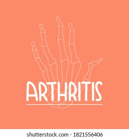 Vector illustration on the theme of World Arthritis Day on October 12. Decorated with a handwritten inscription and diseased arm bones.