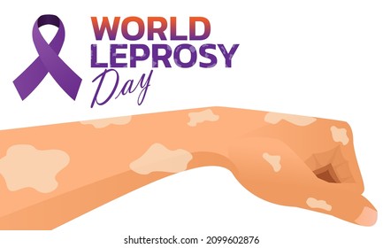 Vector illustration on the theme of World Leprosy Day in January