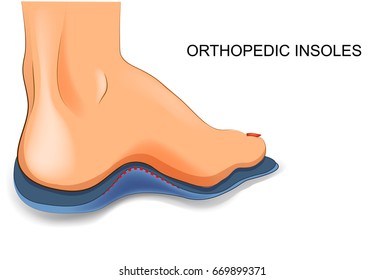 vector illustration of orthopedic insoles for shoes
