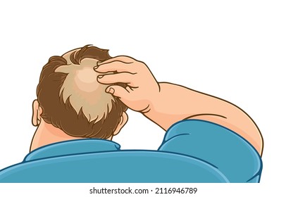 Vector Illustration Of Overweight Man From Behind,neck Back,worried About Hair Loss Problems,baldness,thinking,concerned,hand On Head,lisolated On White Background,Healthy Hair In Obese People.