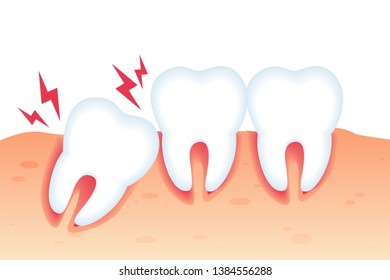 Vector Illustration Pain from Wrong Bite Flat. Dental Diseases and Pain from Abnormal Tooth Growth. Crooked Teeth or Malocclusion. Specialized Orthodontic Care. Dental Pathology Poster.