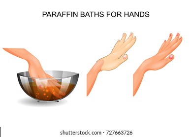 vector illustration of a paraffin baths for hands