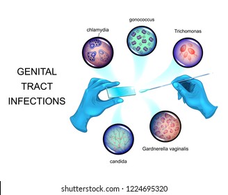 Vector Illustration Of Pathogens Of Sexually Transmitted Infections