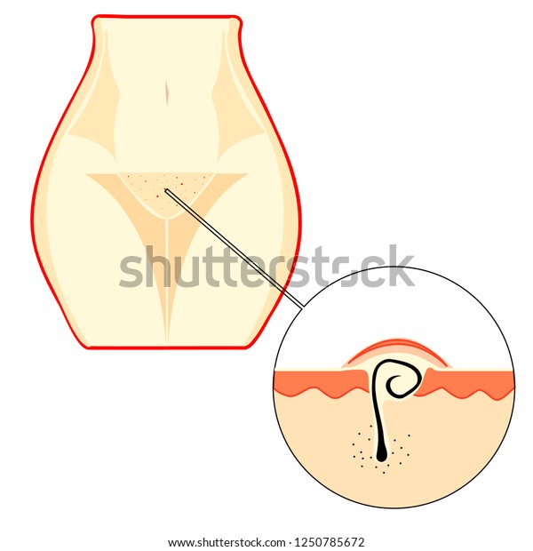 explain more tiny asses penetrated join told all