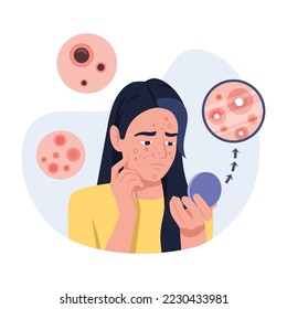 Vector illustration of pimples. Cartoon scene with a girl who was sprinkled with pimples on her face and she looks upset in the mirror on white background.