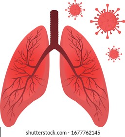 Vector illustration of pneumonia. Coronavirus.