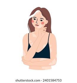 Retrato de ilustración vectorial de una hermosa chica con vitiligo. El concepto de aceptarte a ti mismo y a tu cuerpo. Positividad corporal.