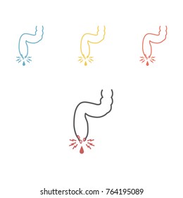 vector illustration of a prolapsed hemorrhoid veins