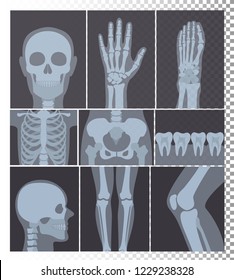 Vector illustration of realistic X-rays shots collection. X-ray pictures of head, bones, teeth set, body parts X ray set on transparent background.