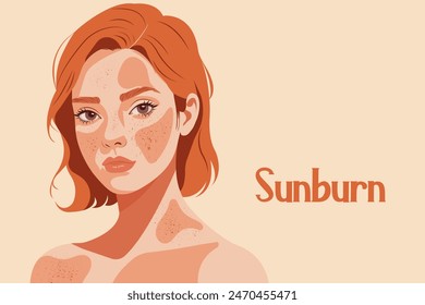 Vector illustration of a red-haired woman with a sunburn on her skin.
