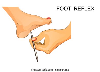 Vector Illustration Of Reflexes Of The Foot.