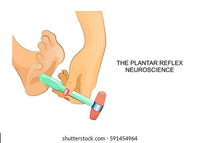 Vector Illustration Of Reflexes Of The Foot.