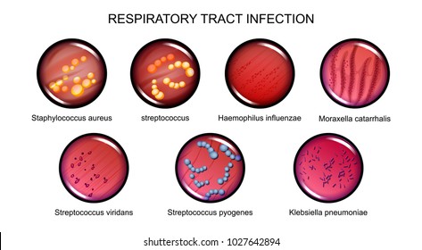 vector illustration of respiratory tract infections. microbiology, bacteriology.