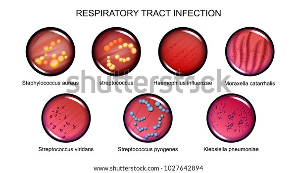 vector illustration of respiratory tract\
infections. microbiology,\
bacteriology.