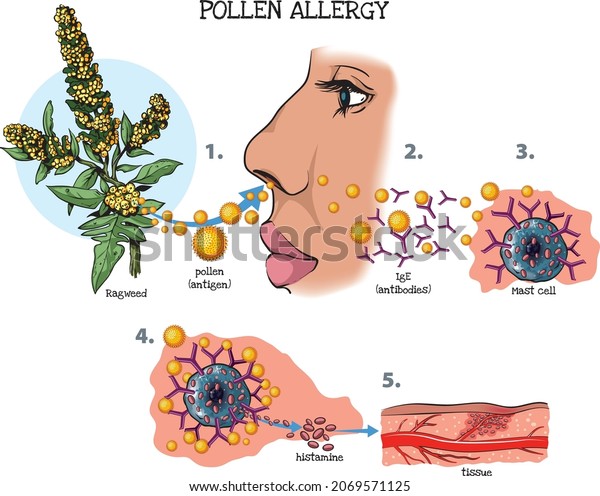 Vector illustration of the response of the immune\
system to pollen\
allergy