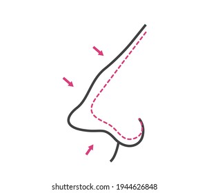 vector illustration of rhinoplasty. cosmetic surgery. aesthetic medicine. vector
