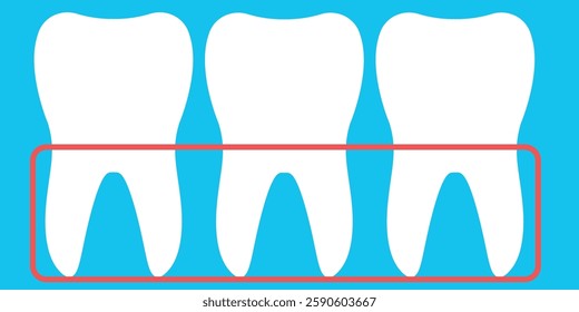 Ilustração vetorial de uma fileira de dentes na gengiva. Uma ilustração educacional com três dentes brancos saudáveis com uma borda vermelha delineando as raízes contra um fundo azul brilhante