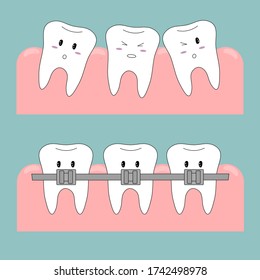 Vector illustration. Selection of images. Funny teeth. Teeth icons. Braces. Correction of teeth.