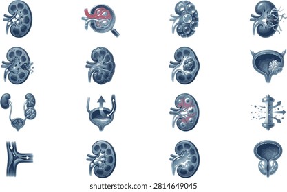 Vector illustration set of human kidney anatomy, renal diseases, and urinary system for medical and healthcare design