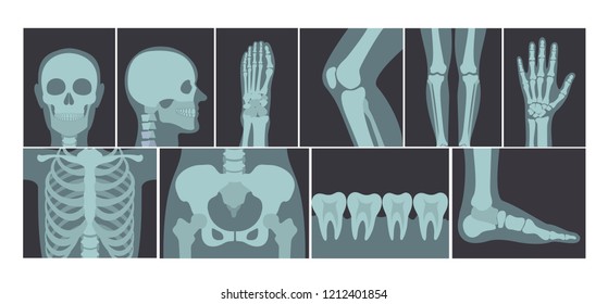 Vector illustration set of many X-rays shots of human body, X-ray pictures of head, hands, legs and other parts of body on white background.