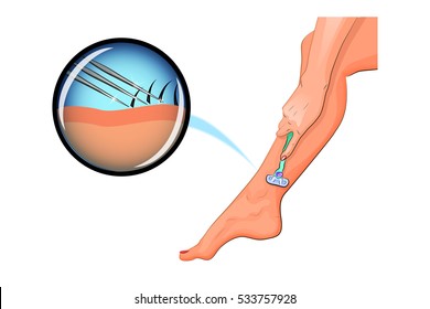 vector illustration of shaving a woman's legs