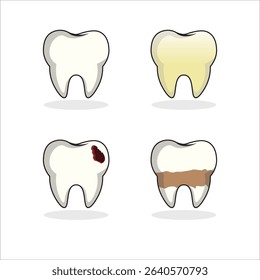 Vector illustration showing four types of teeth: healthy, yellow stained, decayed, and with plaque buildup. Great for dental care or medical content