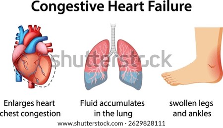 Vector illustration showing heart, lungs, and swollen foot. Highlights symptoms of congestive heart failure with clear, educational visuals