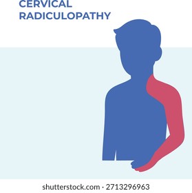 Vektorgrafik mit Schmerzverteilungsbereichen im Zusammenhang mit der Zervikalradikulopathie, wobei Hals-, Schulter- und Armbereiche hervorgehoben werden. Vereinfachte medizinische Grafik für Patientenschulung, phys