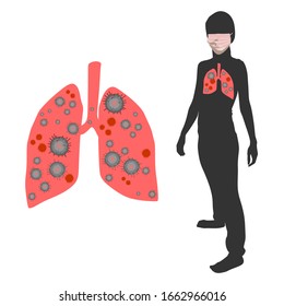 Vector illustration. Silhouette of a girl in a medical mask, the lungs are infected with a virus. Used in the design of posters, manuals, training information