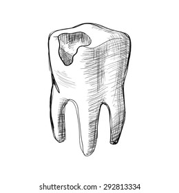 Vector illustration. Sketch. Tooth with tooth decay.