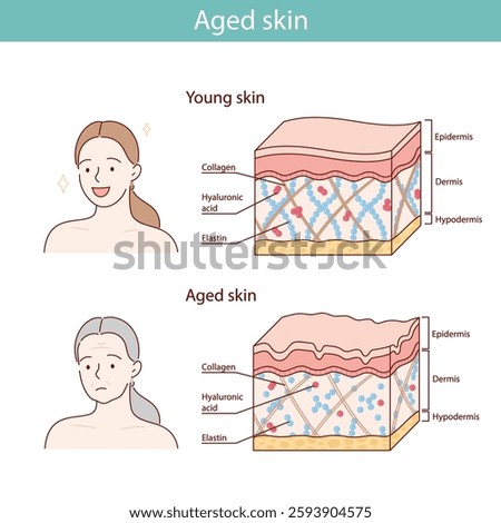 vector illustration of the skin aging process.