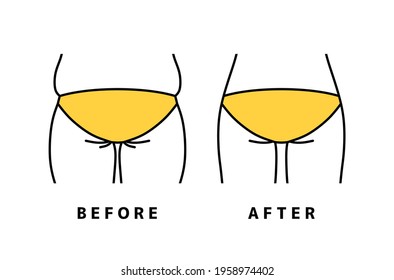 Vector illustration of slimmed hips.