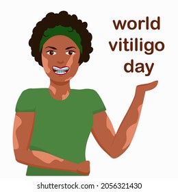 ilustración vectorial de una joven sonriente de piel oscura con vitiligo en la piel y cordones en los dientes. Ilustración sobre el tema del Día Mundial del Vitiligo