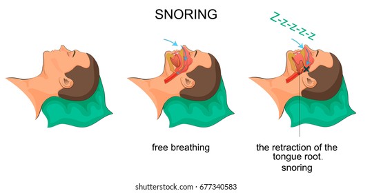 vector illustration of a snoring sleeping man
