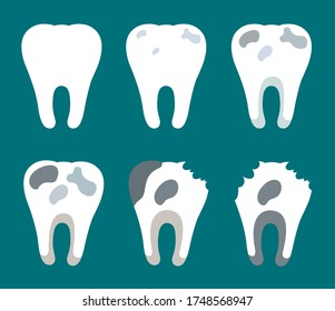 Vector illustration of spoiled teeth. Stages of tooth decay
