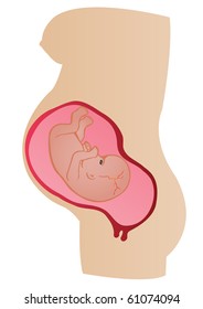 Vector illustration stages of development of a germ in a womb of mother